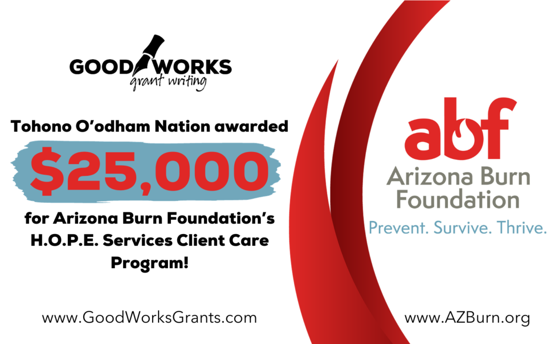 Tribal Grant for Arizona Burn Foundation’s H.O.P.E Services Client Care program